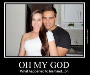 what-happened-to-his-hand-funny-pictures.jpg